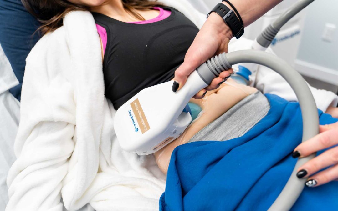 Coolsculpting