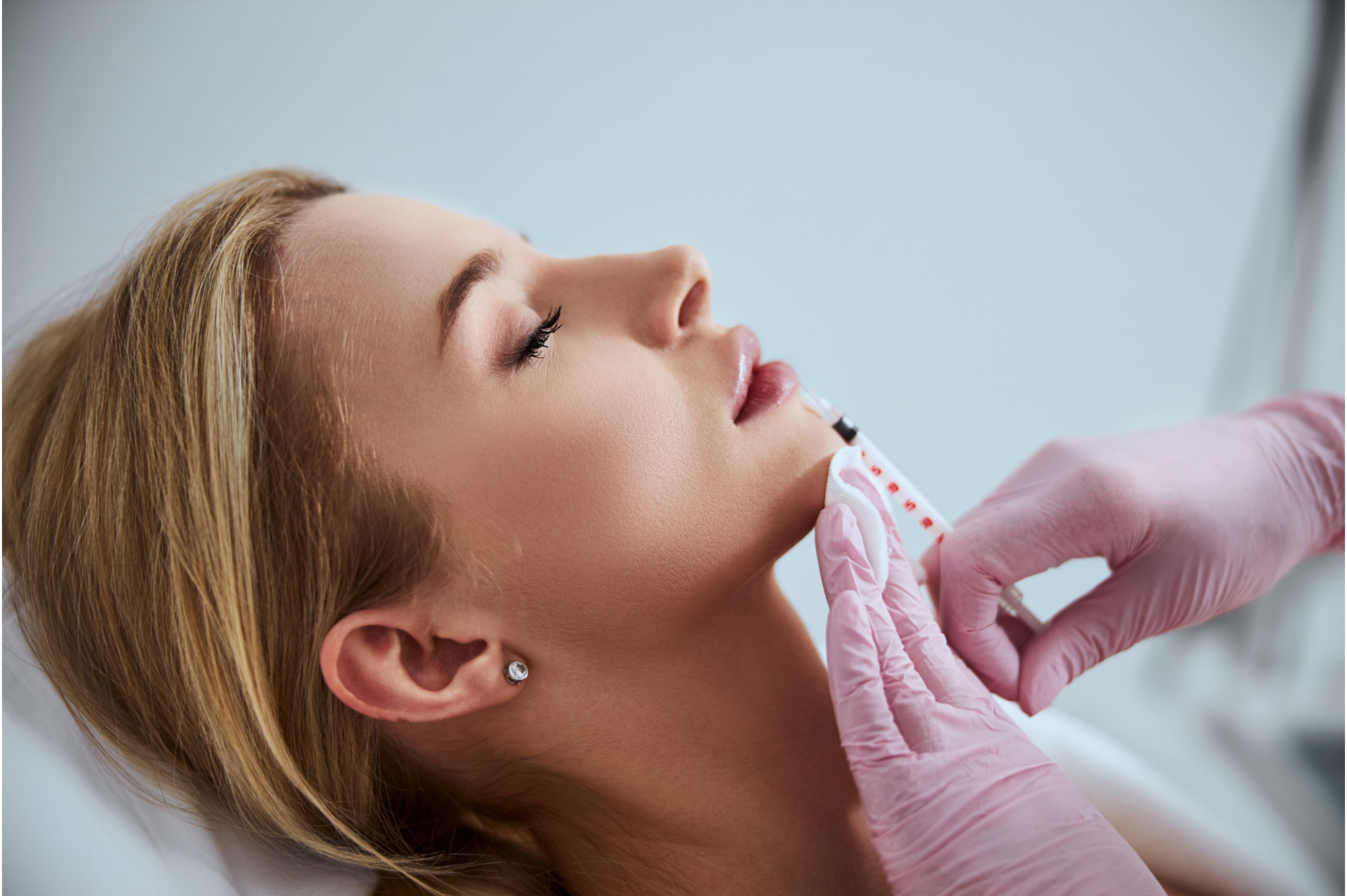 Thread needles being applied